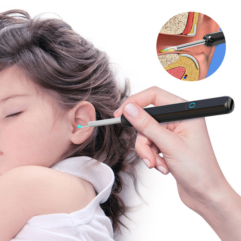 Wi -Fi Visible Wax Elimination Spoon, USB HD Load Otoscope